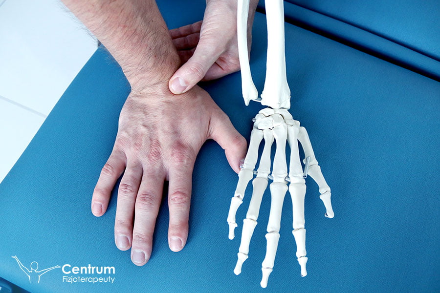 Złamanie kości łódeczkowatej - Centrum Fizjoterapeuty - Przy Złamaniu Kości Przedramienia Należy