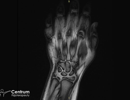 Uraz nadgarstka po upadku